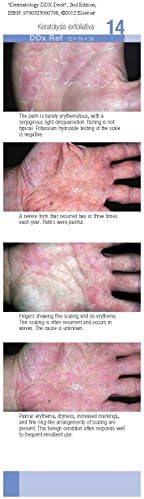 Dermatology DDX Deck by Thomas P. Habif MD