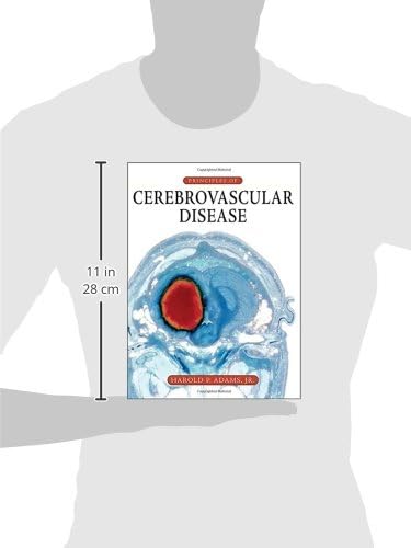 Principles of Cerebrovascular Disease by Harold P. Adams