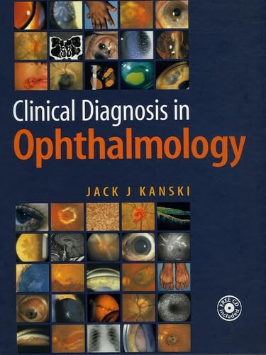 Clinical Diagnosis in Ophthalmology by Jack J. Kanski MD MS FRCS FRCOphth