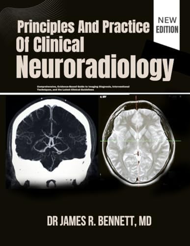 Principles And Practice Of Clinical Neuroradiology: Comprehensive, Evidence-Based Guide to Imaging Diagnosis, Interventional Techniques, and the Latest Clinical Guidelines by DR JAMES R. BENNETT, MD
