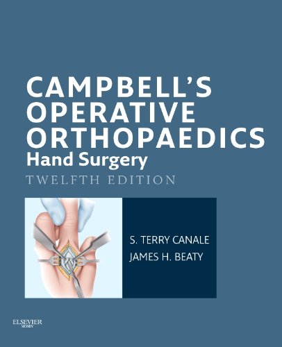 Campbell's Operative Orthopaedics: Hand Surgery E-Book by S. Terry Canale