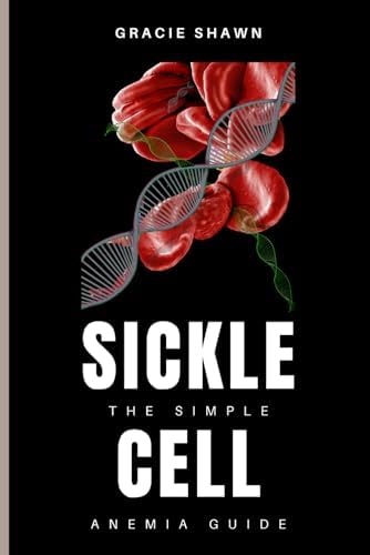 The Simple Sickle Cell Anemia Guide by Gracie Shawn