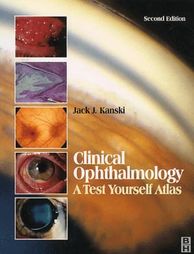 Clinical Ophthalmology: A Test Yourself Atlas by Jack J. Kanski MD MS FRCS FRCOphth