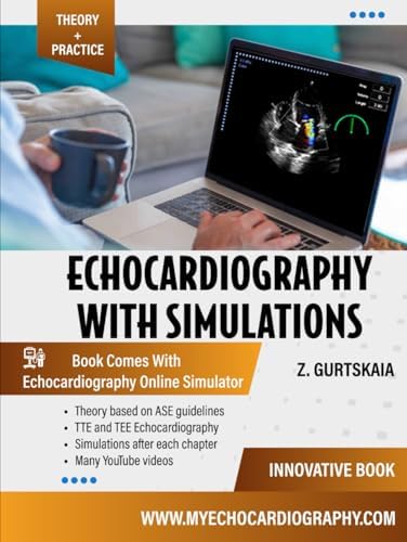 Echocardiography With Simulations by Dr. Zviad Gurtskaia