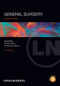 General Surgery (Lecture Notes Book 57) by Harold Ellis