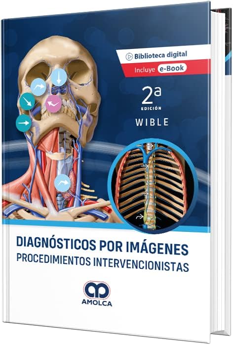 Diagnósticos por Imágenes. Procedimientos Intervencionistas by B. Wible