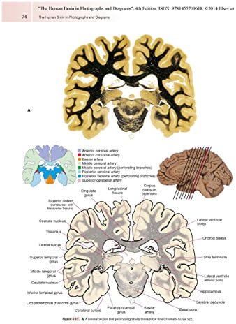 The Human Brain in Photographs and Diagrams: With STUDENT CONSULT Online Access by John Nolte PhD PhD
