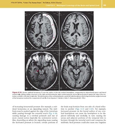 Nolte's The Human Brain: An Introduction to its Functional Anatomy by Todd W. Vanderah PhD
