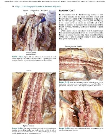 Gray's Clinical Photographic Dissector of the Human Body: with STUDENT CONSULT Online Access (Gray's Anatomy) by Marios Loukas MD PhD