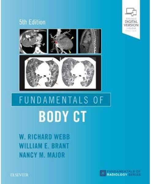 Fundamentals of Body CT (Fundamentals of Radiology) by W Richard Webb MD