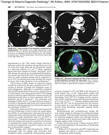 Grainger & Allison's Diagnostic Radiology: 2-Volume Set by Andy Adam CBE MB BS(Hons) PhD FRCP FRCR FRCS