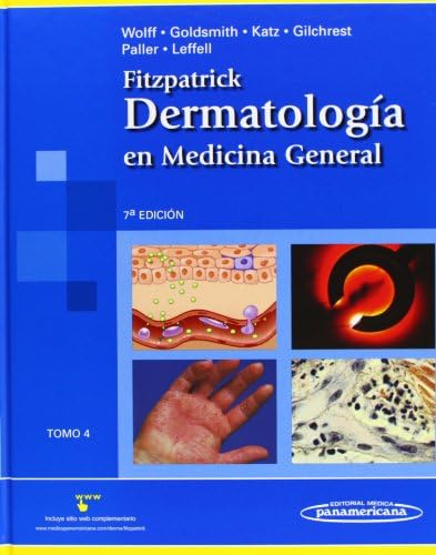 Fitzpatrick. Dermatología en Medicina General: Tomo 4 by Leffell Wolff, Goldsmith, Katz, Gilchrest, Paller