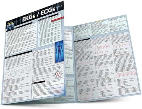 EKGs / ECGs: a QuickStudy Laminated Reference Guide by Lisa Farach