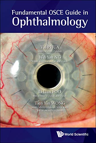 Fundamental Osce Guide In Ophthalmology by Val Jun Rong Phua