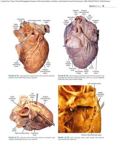 Gray's Clinical Photographic Dissector of the Human Body: with STUDENT CONSULT Online Access (Gray's Anatomy) by Marios Loukas MD PhD