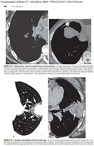 Fundamentals of Body CT (Fundamentals of Radiology) by W Richard Webb MD