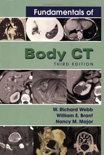 Fundamentals of Body Ct (3rd Edition) by W Richard Webb MD