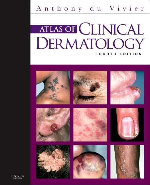 Atlas of Clinical Dermatology (du Vivier, Atlas of Clinical Dermatology) by Anthony du Vivier MD FRCP