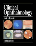 Clinical Ophthalmology: A Systematic Approach by Jack J. Kanski