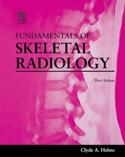 Fundamentals of Skeletal Radiology by Clyde A. Helms