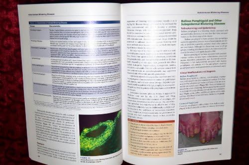 MKSAP 15 Medical Knowledge Self-assessment Program: Dermatology by American College of Physicians (2010) Paperback by American College of Physicians