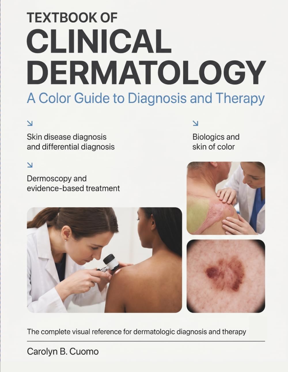 TEXTBOOK OF CLINICAL DERMATOLOGY: The Complete Visual Reference for Skin Disease Diagnosis, Differential Diagnosis, and Evidence-Based Treatment With Dermoscopy, Biologics, and Skin of Color by Carolyn B. Cuomo