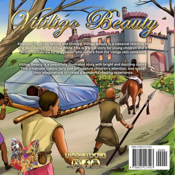 Vitiligo Beauty: A Retelling of Snow White (Black Fairy Tales) by King Ki'el