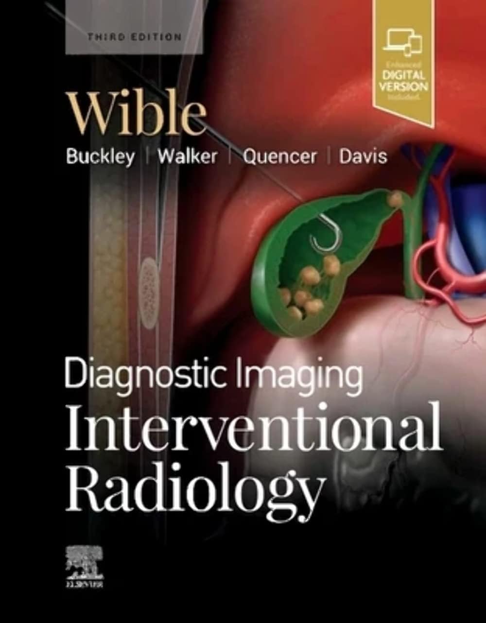 Diagnostic Imaging: Interventional Radiology by Brandt C. Wible MD