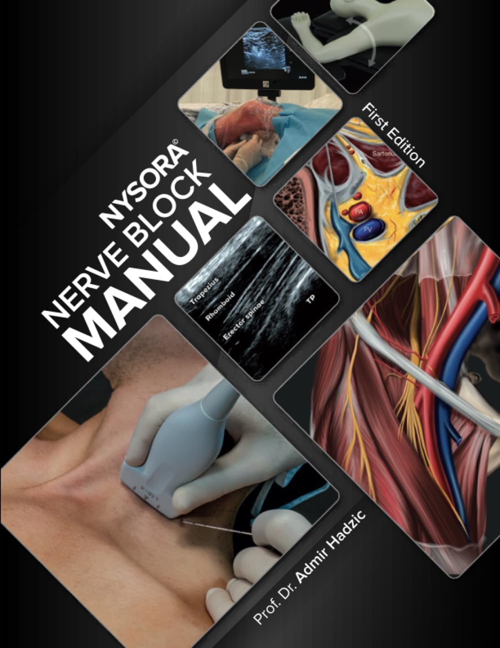 NYSORA Nerve Block Manual: First Edition (Regional Anesthesia) by Admir Hadzic