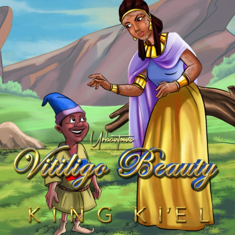 Vitiligo Beauty: A Retelling of Snow White (Black Fairy Tales) by King Ki'el