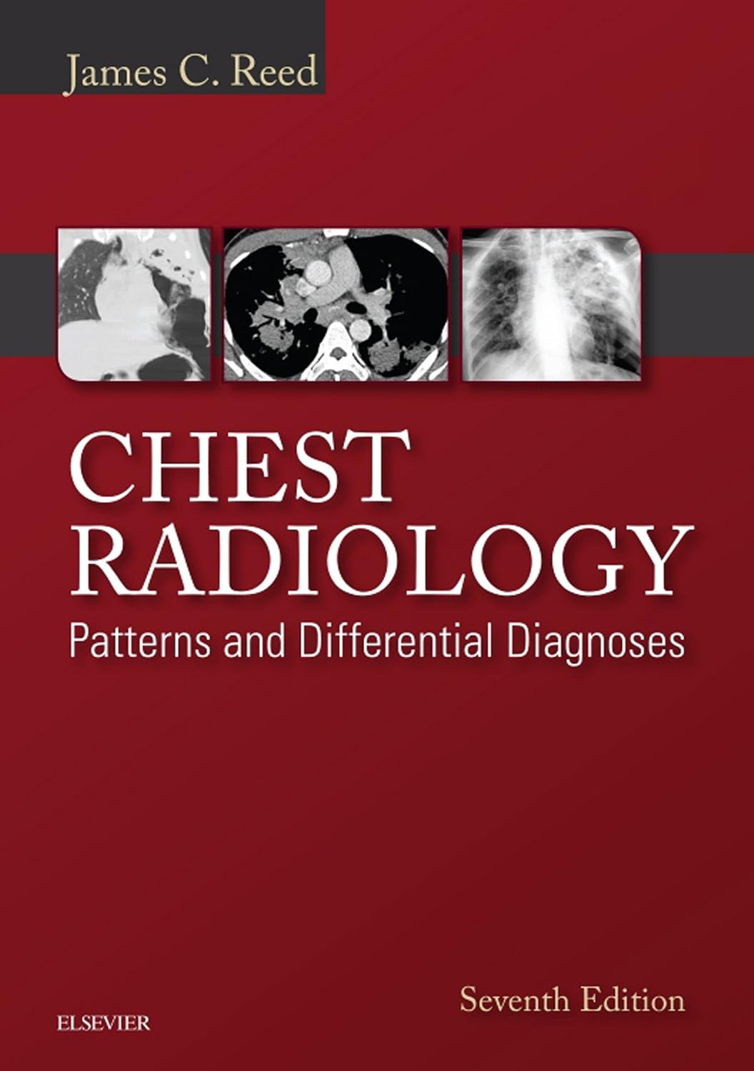 Chest Radiology: Patterns and Differential Diagnoses E-Book by James C. Reed MD