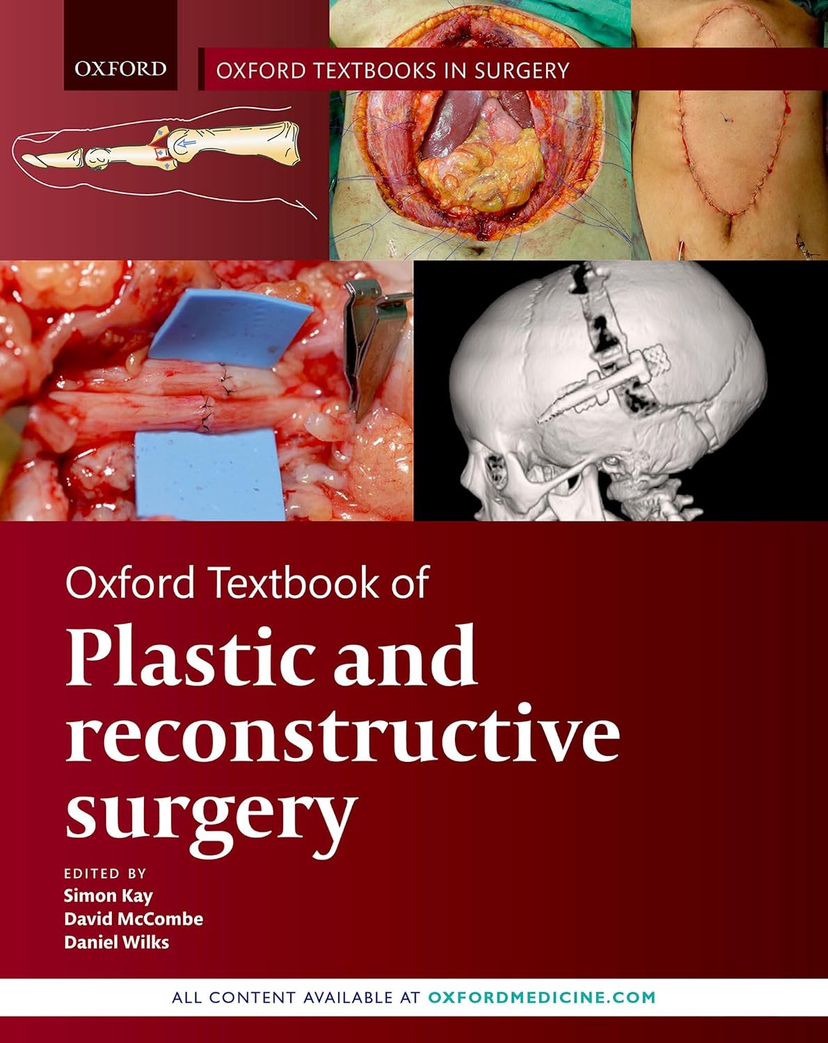 Oxford Textbook of Plastic and Reconstructive Surgery (Oxford Textbooks in Surgery) by Simon Kay