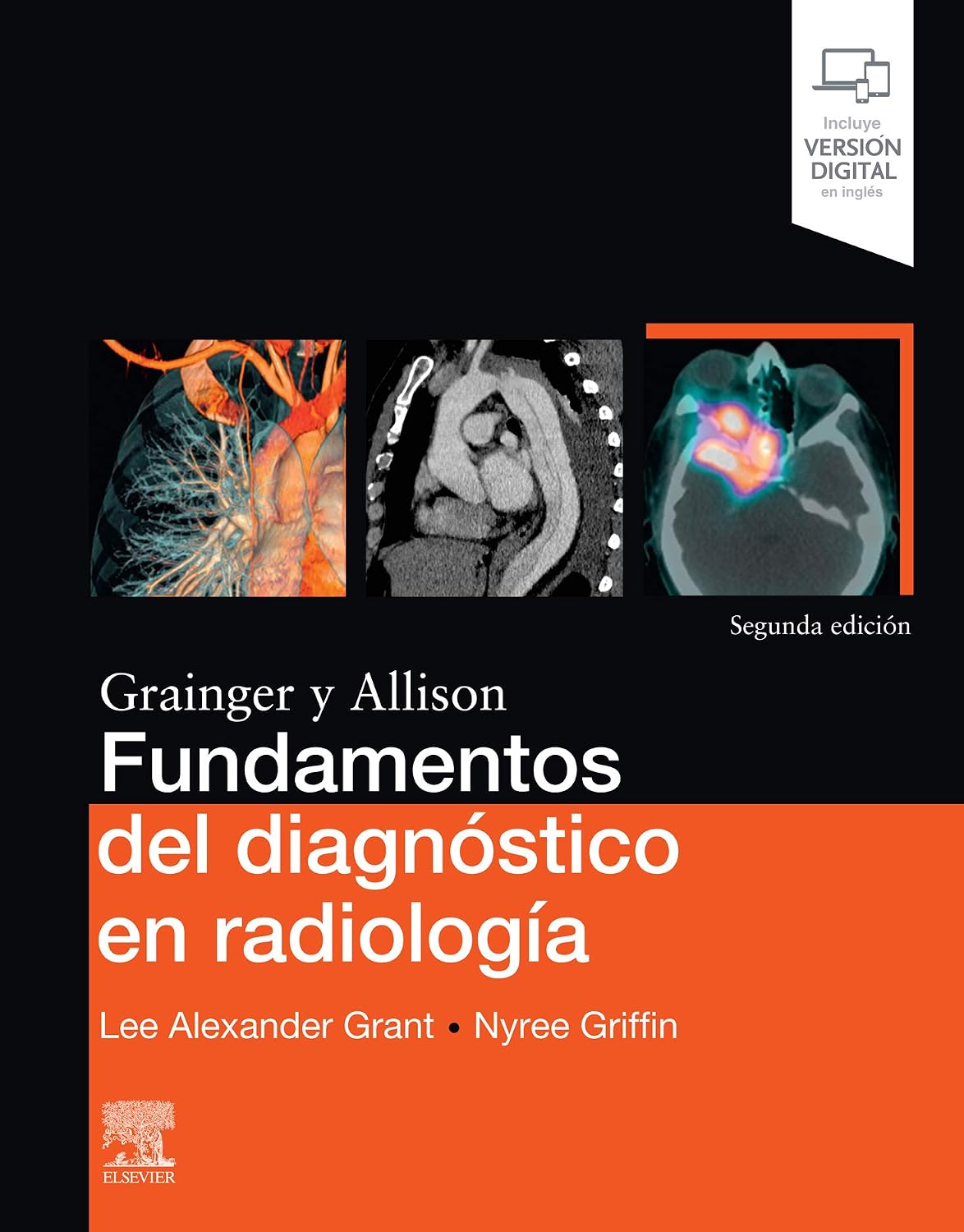 Fundamentos del diagnóstico en radiología (Spanish Edition) by Lee A. Grant MB ChB, BA(Oxon), MRCS, FRCR