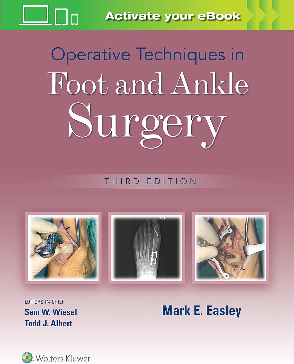 Operative Techniques in Foot and Ankle Surgery by Mark E. Easley MD