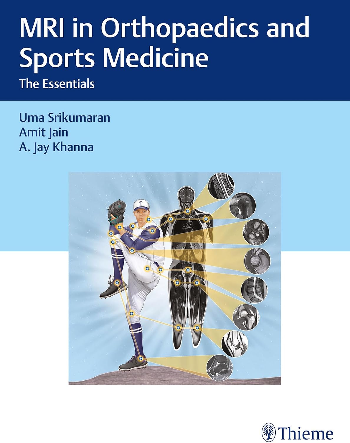 MRI in Orthopaedics and Sports Medicine: The Essentials by Uma Srikumaran