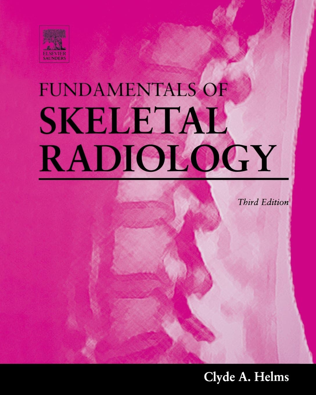 Fundamentals of Skeletal Radiology by Clyde A. Helms