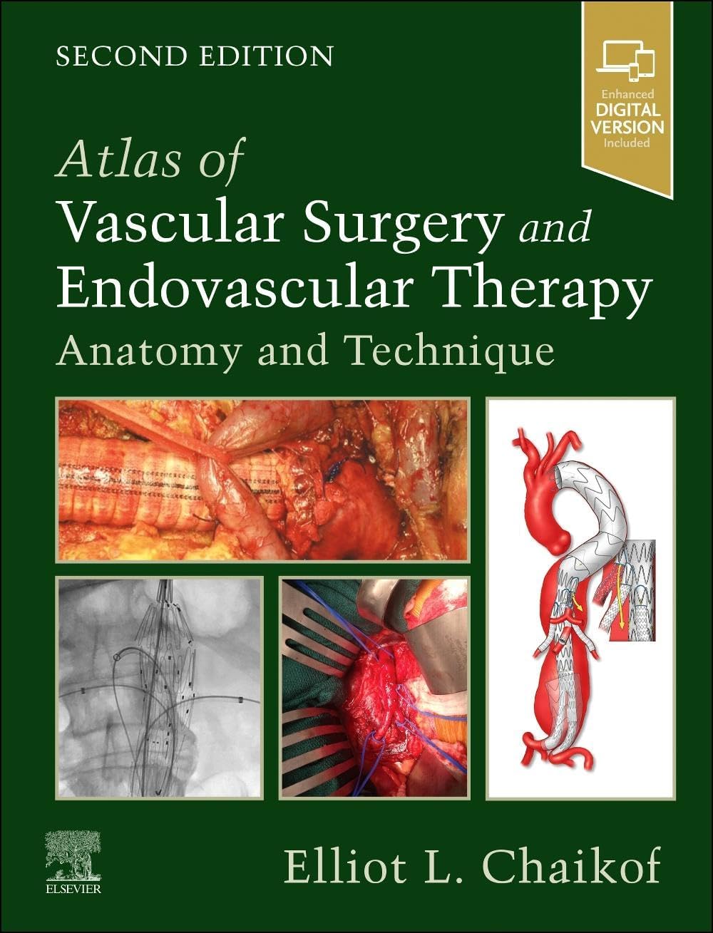 Atlas of Vascular Surgery and Endovascular Therapy: Anatomy and Technique by Elliot L. Chaikof MD PhD