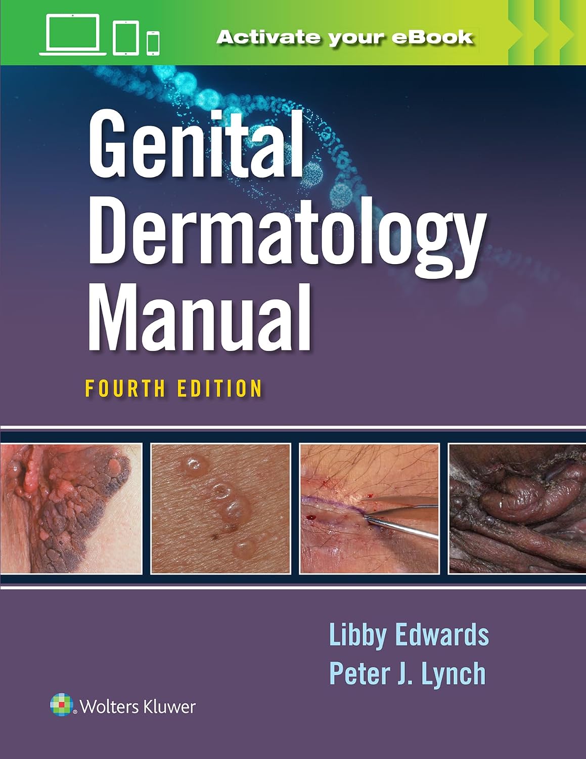 Genital Dermatology Manual by Elizabeth Edwards