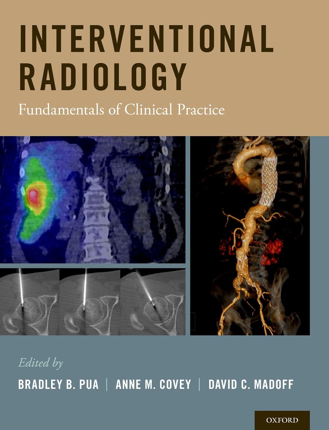 Interventional Radiology: Fundamentals of Clinical Practice by Bradley B. Pua