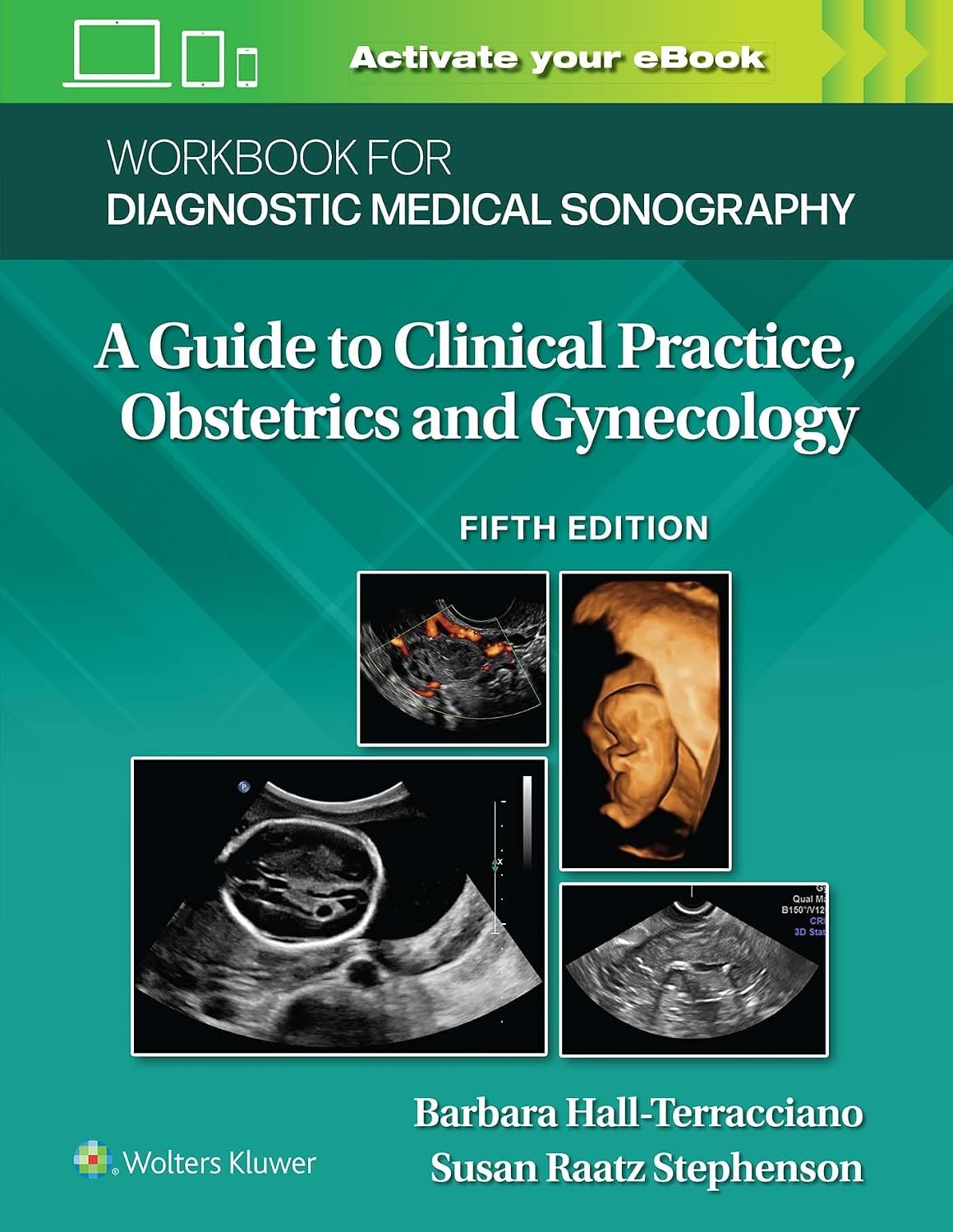 Workbook for Diagnostic Medical Sonography: Obstetrics and Gynecology (Lippincott Connect) by Susan Stephenson