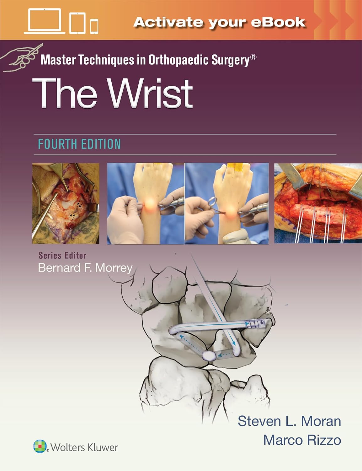 Master Techniques in Orthopaedic Surgery: The Wrist: Print + eBook with Multimedia by STEVEN L MORAN