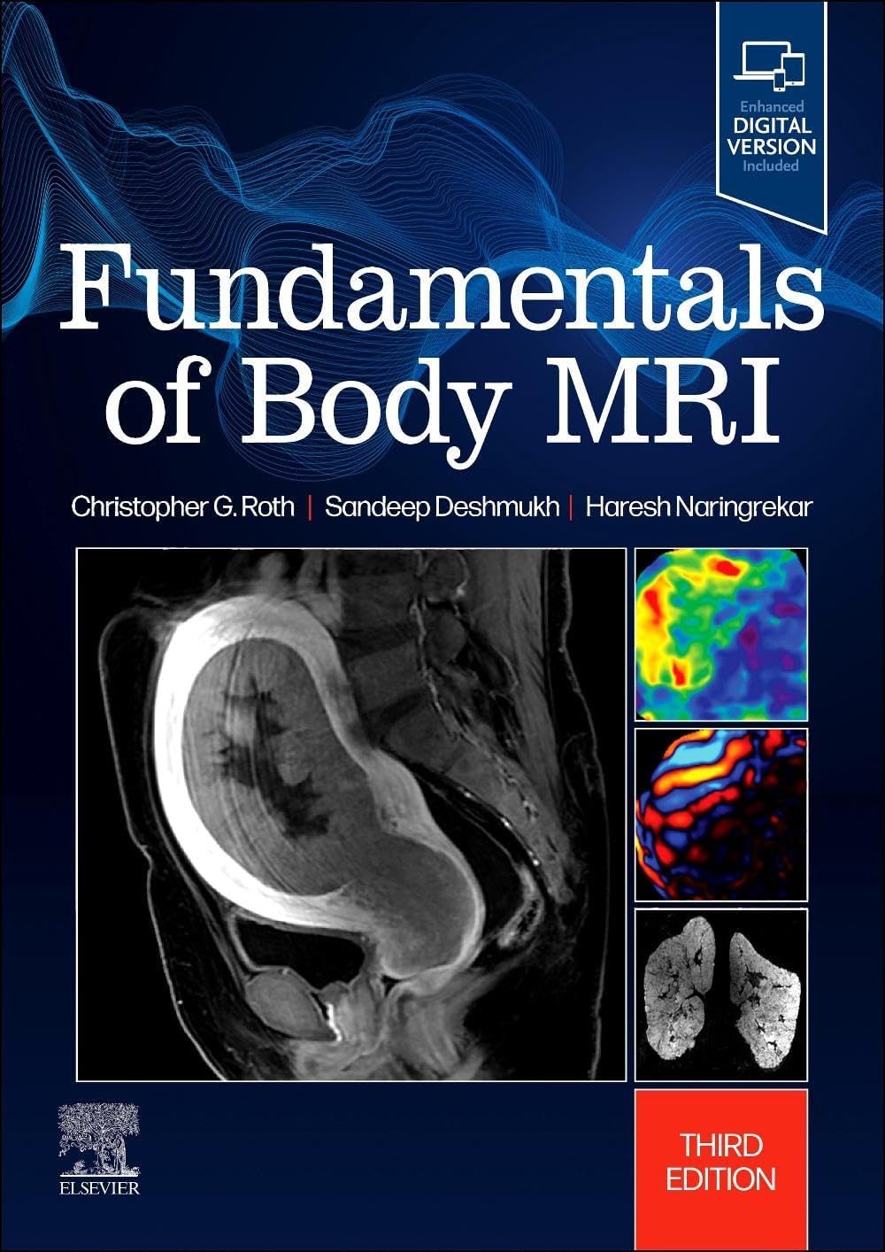 Fundamentals of Body MRI (Fundamentals of Radiology) by Christopher G. Roth MD