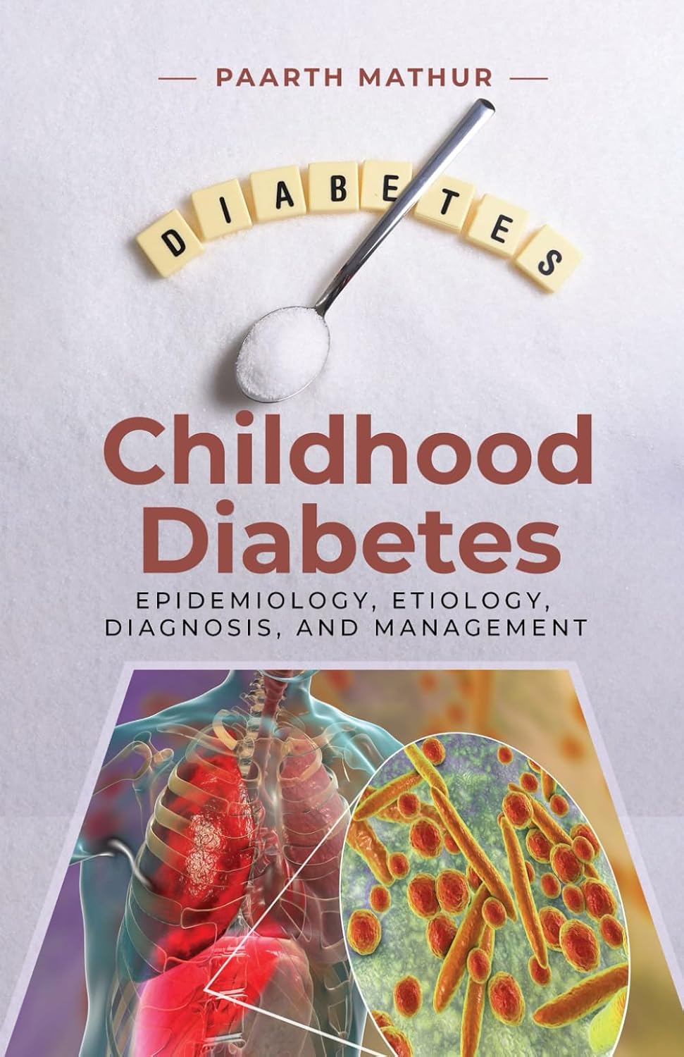 Childhood Diabetes: An In-Depth Analysis of Epidemiology, Etiology, Diagnosis, and Management by Paarth Mathur