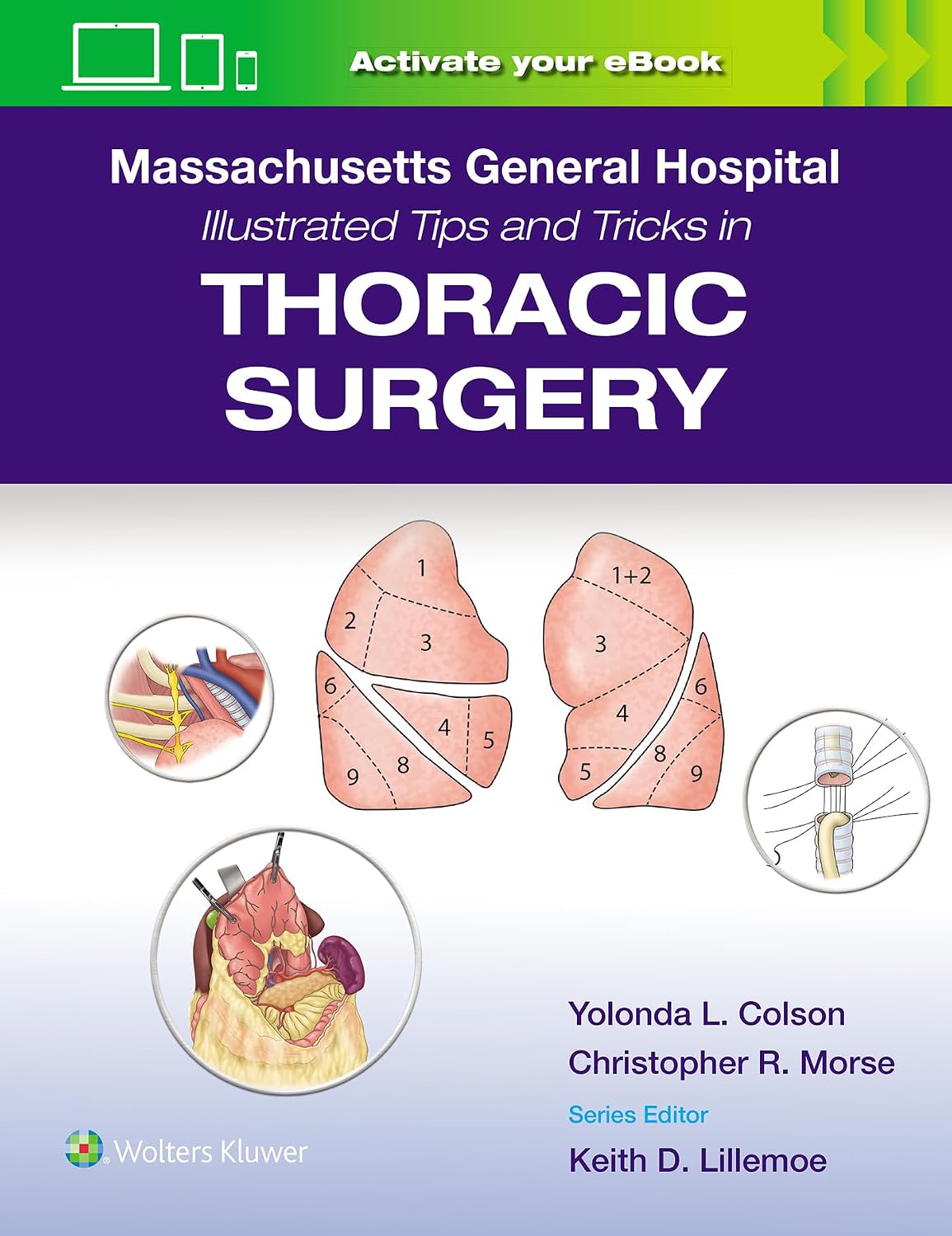 Massachusetts General Hospital Illustrated Tips and Tricks in Thoracic Surgery: Print + eBook with Multimedia by Yolonda Colson