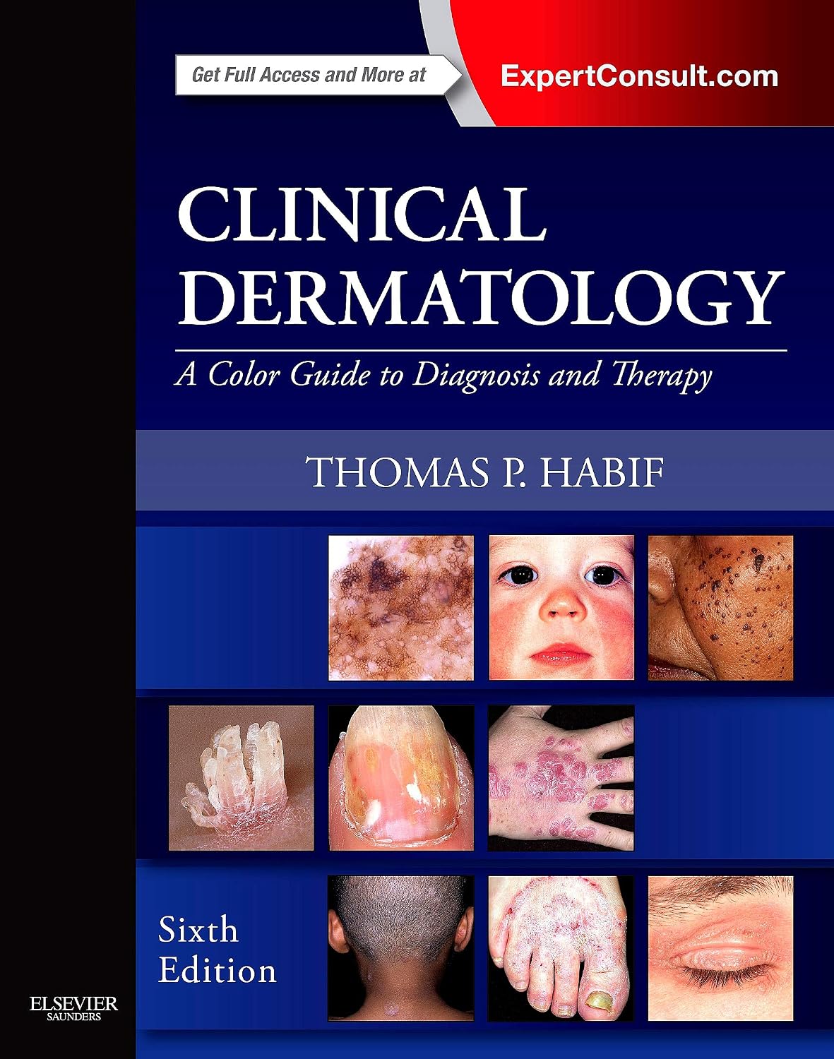 Clinical Dermatology: A Color Guide to Diagnosis and Therapy by Thomas P. Habif MD