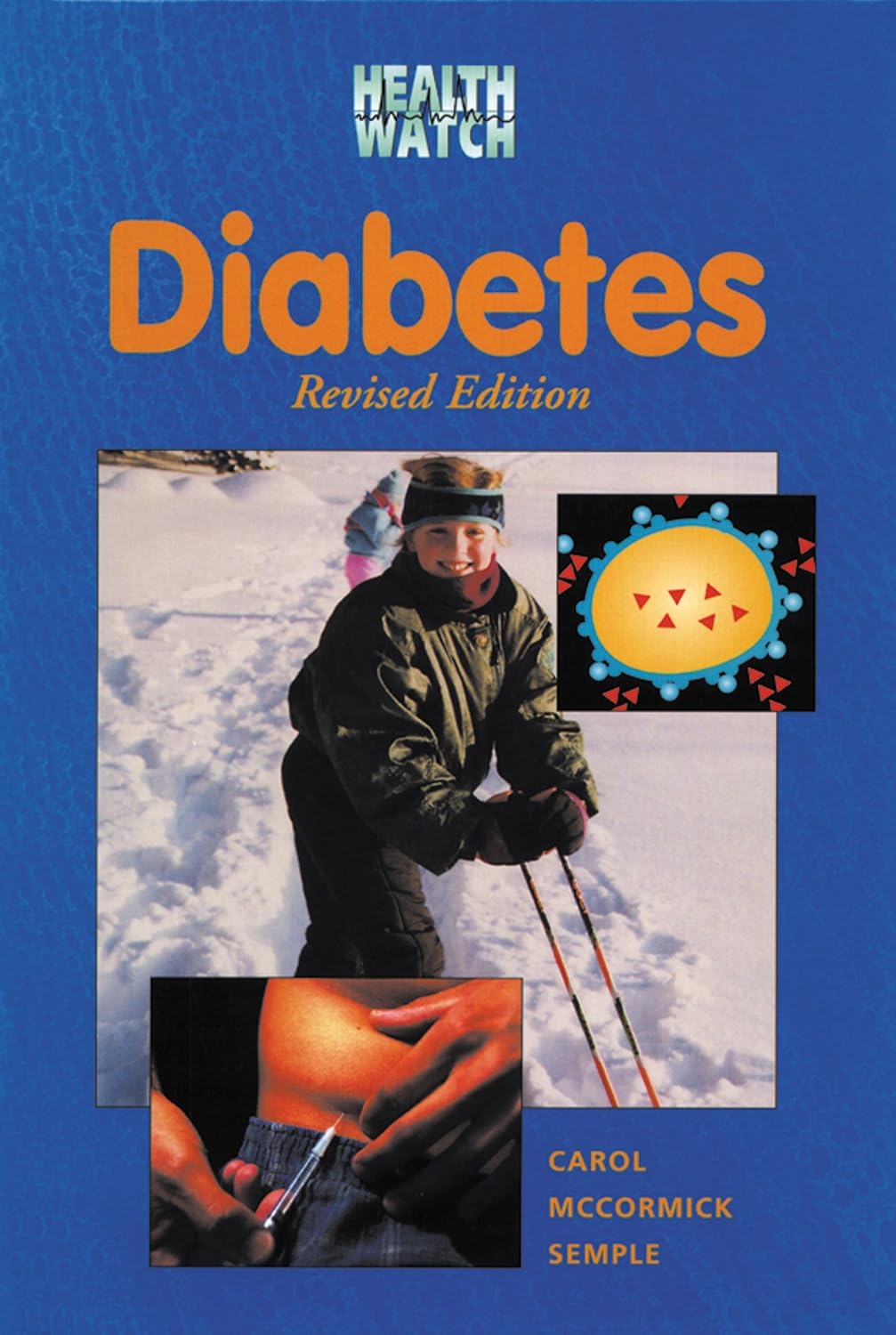 Diabetes (Health Watch) by Carol McCormick Semple