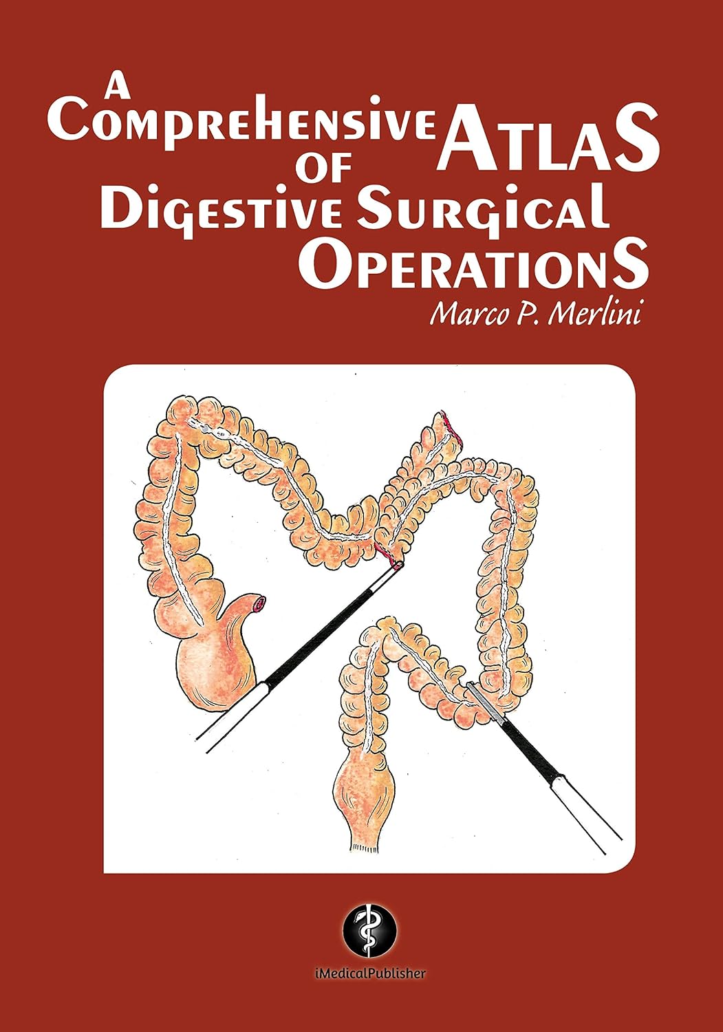 A Comprehensive Atlas of Digestive Surgical Operations by Marco Merlini