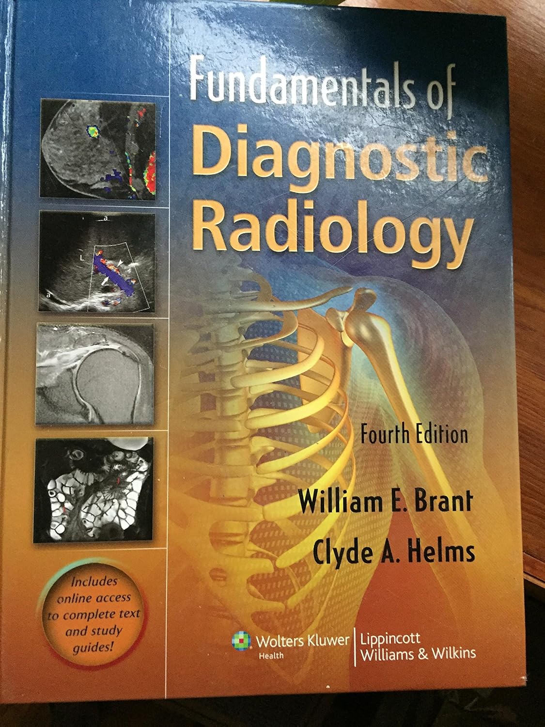 Fundamentals of Diagnostic Radiology by M.D. Brant, William E.