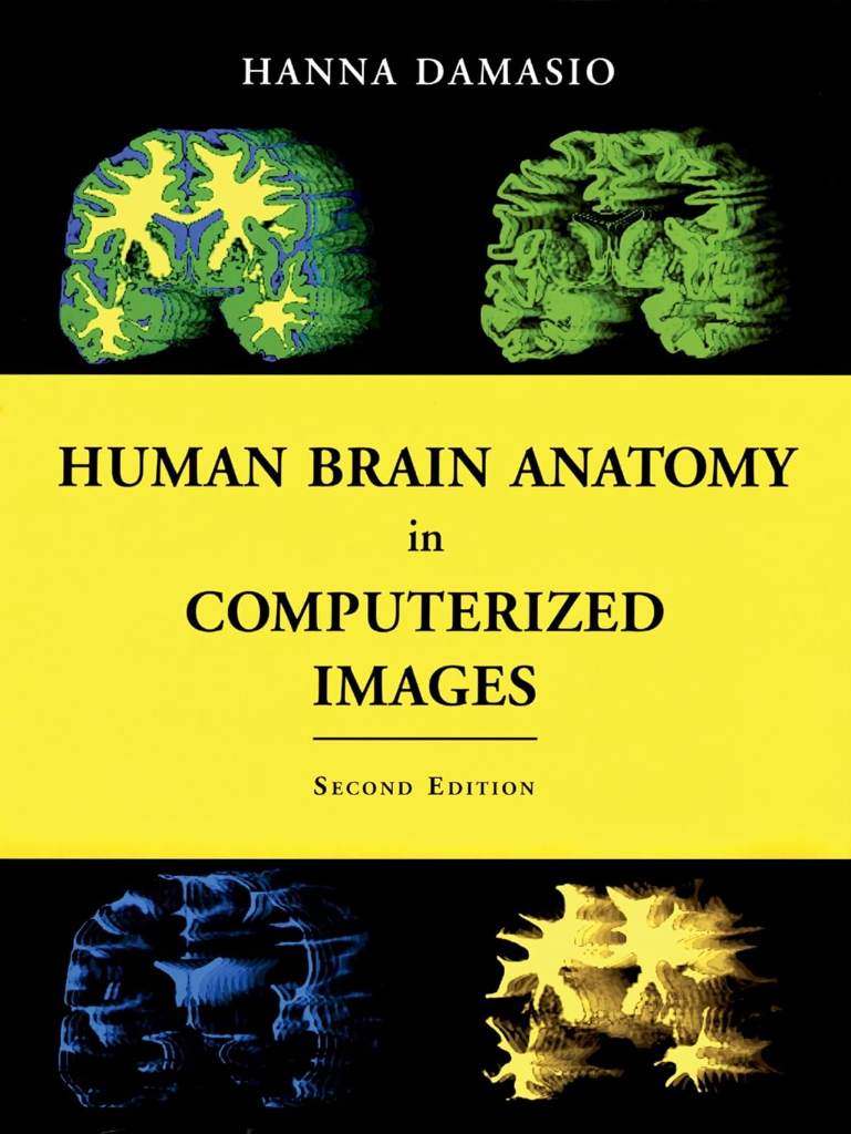 Human Brain Anatomy in Computerized Images by Hanna Damasio M.D. - 9780195165616