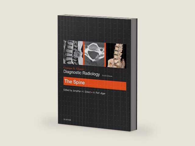 Grainger & Allison’s Diagnostic Radiology: The Spine by Jonathan H Gillard BSc MA MD FRCR FRCP MBA | barcode:9780702069345 | source:'9780702069345-right-three-quarter.jpg